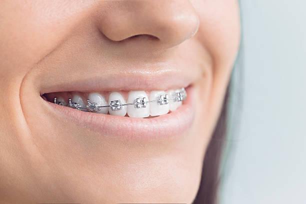 Best Invisalign and Clear Aligners  in Brighton, MI